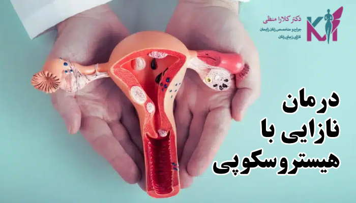 درمان نازایی با هیستروسکوپی