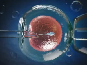 درمان ناباروری با ivf