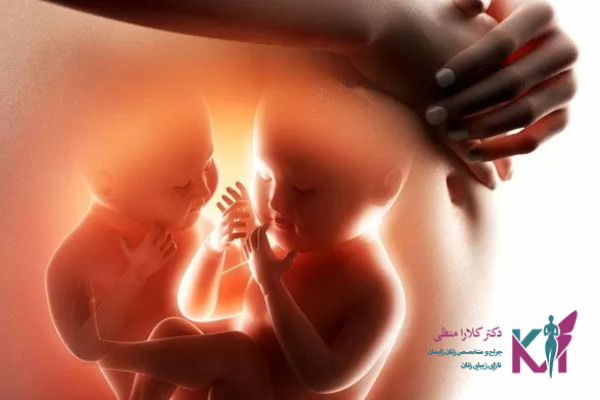 چگونه متوجه بارداری چند قلویی خود شویم؟