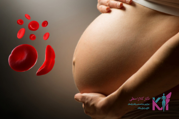 عوارض خطر آفرین کم خونی شدید در بارداری