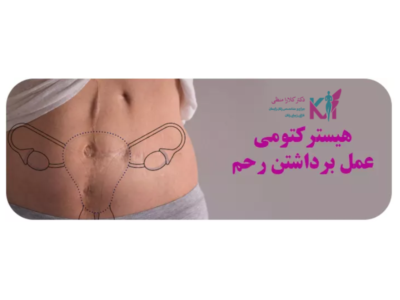 هیسترکتومی یا برداشتن رحم (در تبریز)