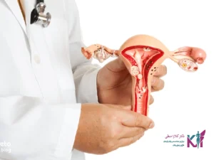 بهترین جراح فیبروم رحم در تبریز
