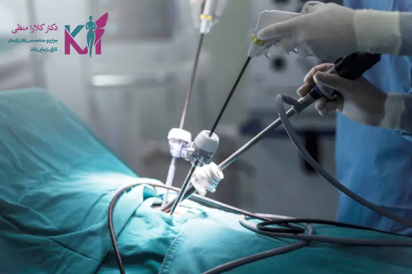 نحوه ارزیابی تجربه و مهارت جراح فیبروم رحم