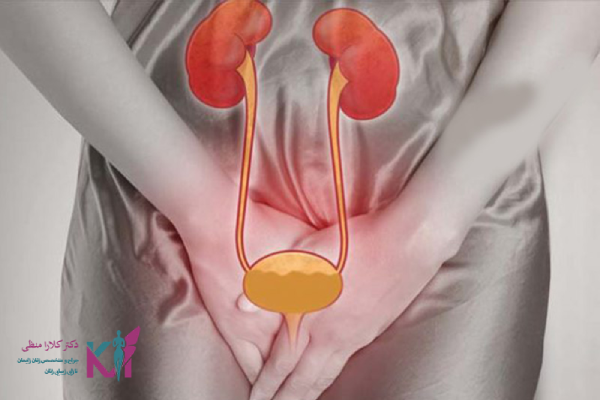 روشهای تشخیص افتادگی مثانه