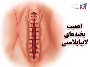 اهمیت بخیههای لابیاپلاستی